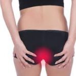 90% of hemorrhoids do not need to be treated, 3 tips need to be done